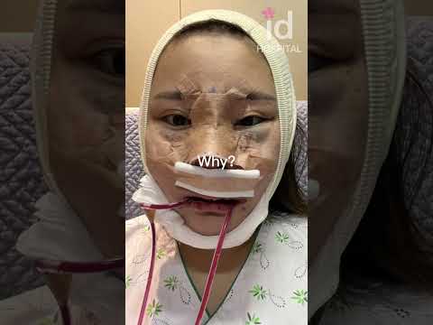 Plastic surgery transformation in Korea #idhospital #shorts